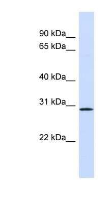 Western Blot: FGF14 Antibody [NBP1-69006]