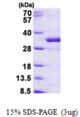 SDS-PAGE: Recombinant Human FGF14 His Protein [NBP2-23050]
