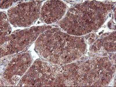 Immunohistochemistry-Paraffin: FGF-21 Antibody (OTI2F10) [NBP2-00645]