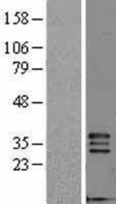 Western Blot: FGF-5 Overexpression Lysate [NBL1-10698]