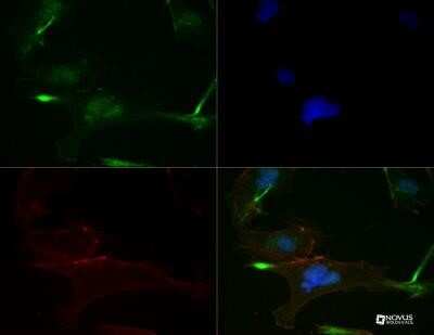 Immunocytochemistry/ Immunofluorescence: FGFR1 Antibody (M17D10) - Azide and BSA Free [NBP2-80733]