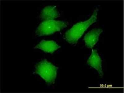 Immunocytochemistry/ Immunofluorescence: FGFR1OP Antibody (2B1) [H00011116-M01]