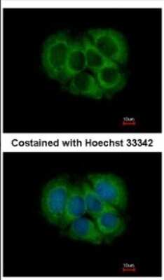 Immunocytochemistry/ Immunofluorescence: FGFR1OP2 Antibody [NBP2-16479]