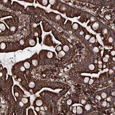 Immunohistochemistry-Paraffin: FGFR1OP2 Antibody [NBP1-84149]