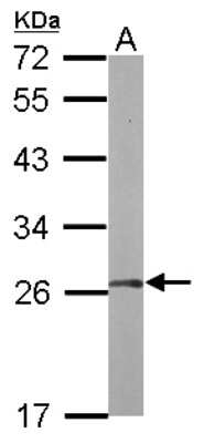 Western Blot: FGFR1OP2 Antibody [NBP2-16479]