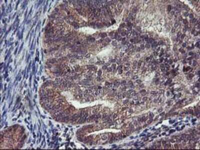 Immunohistochemistry-Paraffin: FGFR2 Antibody (OTI5C5) [NBP2-00932]