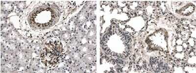 Immunohistochemistry: FGFR2 Antibody (7C24) - Azide and BSA Free [NB110-94154]