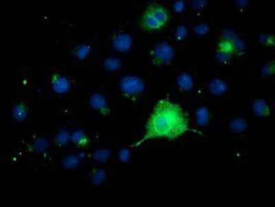 Immunocytochemistry/ Immunofluorescence: FGFR2 Antibody (OTI5C5) - Azide and BSA Free [NBP2-70731]