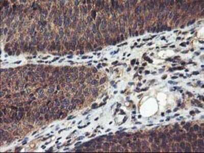 Immunohistochemistry: FGFR2 Antibody (OTI5C5) - Azide and BSA Free [NBP2-70731]