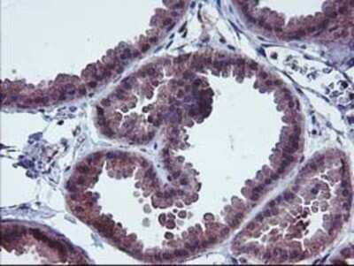 Immunohistochemistry: FGFR2 Antibody (OTI5C5) - Azide and BSA Free [NBP2-70731]