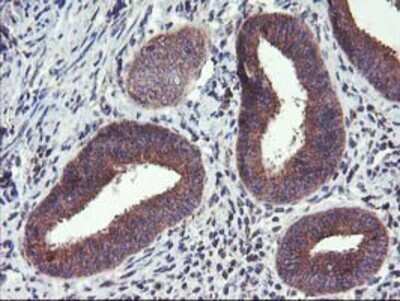 Immunohistochemistry: FGFR2 Antibody (OTI5C5) - Azide and BSA Free [NBP2-70731]