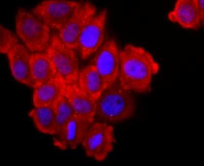 Immunocytochemistry/ Immunofluorescence: FGFR3 Antibody (JM110-33) [NBP2-66840]