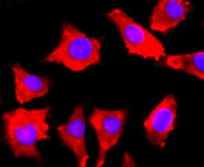 Immunocytochemistry/ Immunofluorescence: FGFR3 Antibody (JM110-33) [NBP2-66840]
