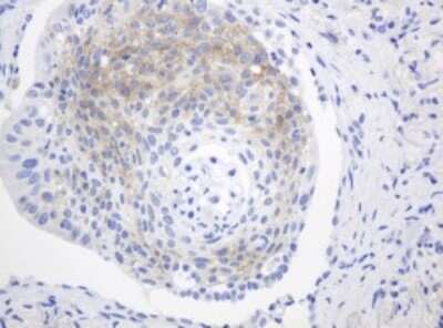 Immunohistochemistry: FGFR3 Antibody (OTI1B10) - Azide and BSA Free [NBP2-70722]