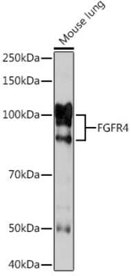 Western Blot: FGFR4 Antibody (2C4E1) [NBP3-16784]