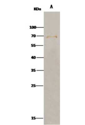 Immunoprecipitation: FGFR5/FGFRL1 Antibody (019) [NBP2-90467]