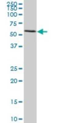 Western Blot: FGL2/Fibroleukin Antibody (5A10) [H00010875-M02]