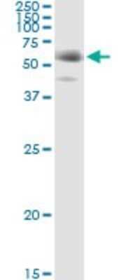Immunoprecipitation: FGL2/Fibroleukin Antibody (6D9) [H00010875-M01]