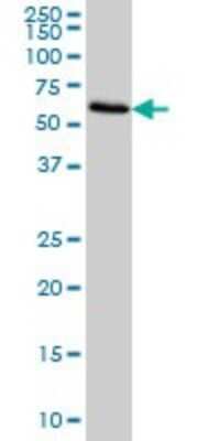 Western Blot: FGL2/Fibroleukin Antibody (6D9) [H00010875-M01]