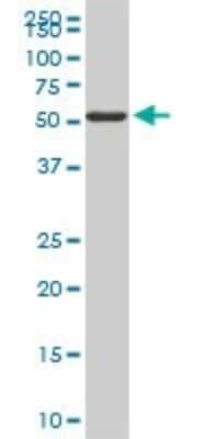 Western Blot: FGL2/Fibroleukin Antibody (6D9) [H00010875-M01]