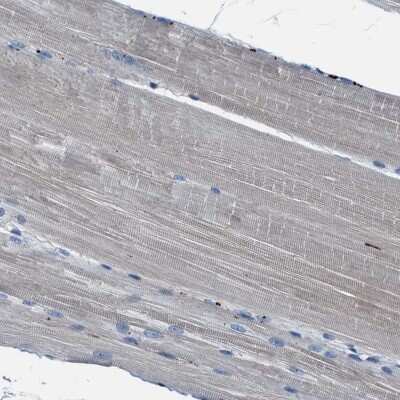 Immunohistochemistry-Paraffin: FGL2/Fibroleukin Antibody [NBP1-87198]