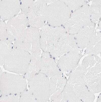Immunohistochemistry-Paraffin: FGL2/Fibroleukin Antibody [NBP1-87199]
