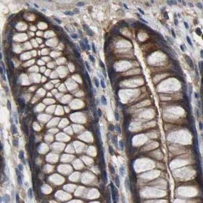 Immunohistochemistry-Paraffin: FHIT Antibody [NBP1-89061]