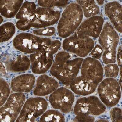 Immunohistochemistry-Paraffin: FHIT Antibody [NBP1-89062]