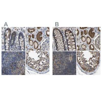 Immunohistochemistry-Paraffin: FHIT Antibody [NBP1-89062]