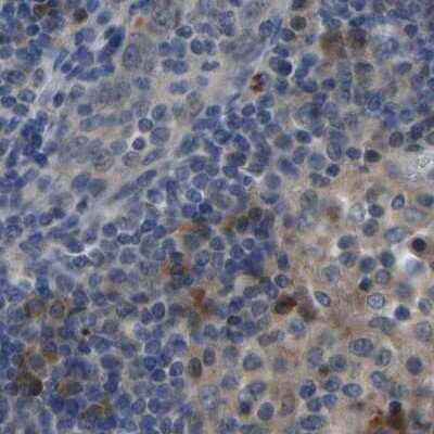 Immunohistochemistry-Paraffin: FHIT Antibody [NBP1-89062]