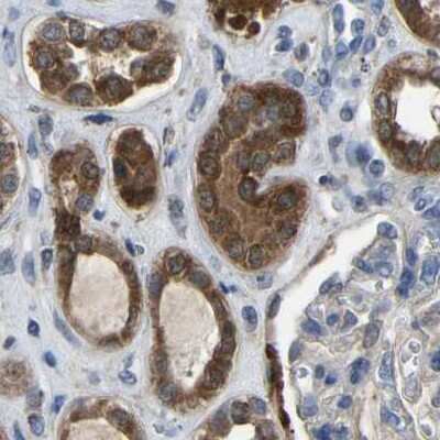 Immunohistochemistry-Paraffin: FHIT Antibody [NBP1-89062]