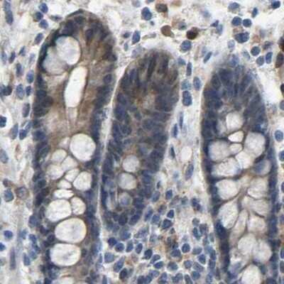 Immunohistochemistry-Paraffin: FHIT Antibody [NBP1-89062]