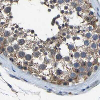 Immunohistochemistry-Paraffin: FHIT Antibody [NBP1-89062]