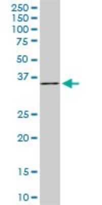 Western Blot: FHL1 Antibody (2A9) [H00002273-M01]
