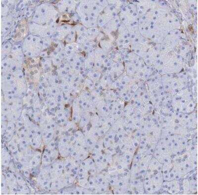 Immunohistochemistry-Paraffin: FHL1 Antibody [NBP1-88745]