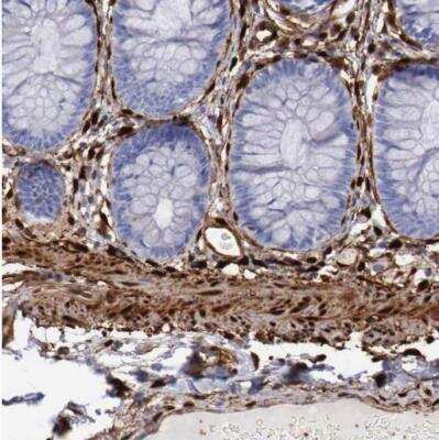 Immunohistochemistry-Paraffin: FHL1 Antibody [NBP1-88745]