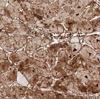 Immunohistochemistry-Paraffin: FHL1 Antibody [NBP1-88745]