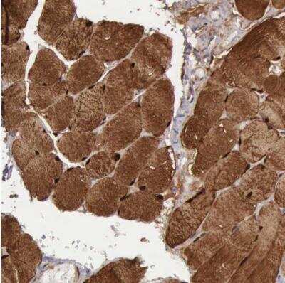 Immunohistochemistry-Paraffin: FHL1 Antibody [NBP1-88745]