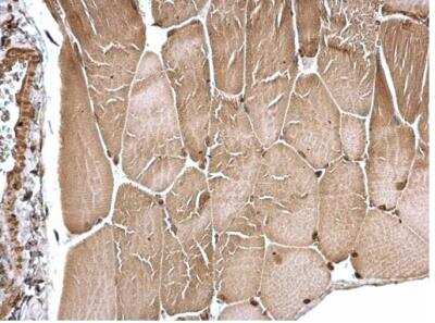 Immunohistochemistry-Paraffin: FHL1 Antibody [NBP2-16490]