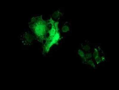 Immunocytochemistry/ Immunofluorescence: FHL1 Antibody (OTI3G7) - Azide and BSA Free [NBP2-70739]