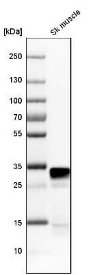 Western Blot: FHL1 Antibody [NBP1-88745]