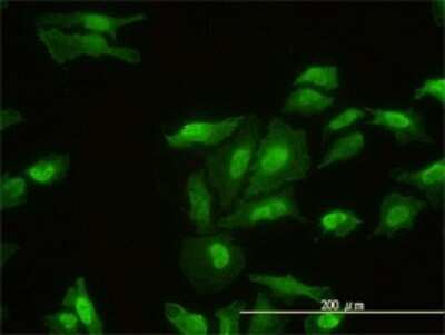 Immunocytochemistry/ Immunofluorescence: FHL2 Antibody (2G3-1A5) [H00002274-M01]