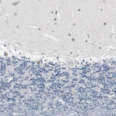 Immunohistochemistry-Paraffin: FHL2 Antibody [NBP1-84979]
