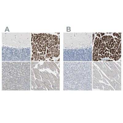 Immunohistochemistry-Paraffin: FHL2 Antibody [NBP1-84979]