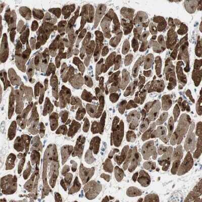 Immunohistochemistry-Paraffin: FHL2 Antibody [NBP1-84979]