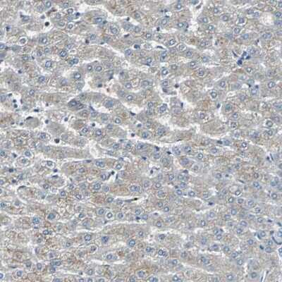 Immunohistochemistry-Paraffin: FHL2 Antibody [NBP1-84979]