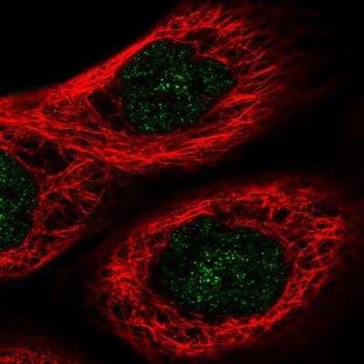 Immunocytochemistry/ Immunofluorescence: FHL3 Antibody [NBP1-91899]