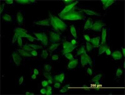 Immunocytochemistry/ Immunofluorescence: FHL5 Antibody (1G12-D2) [H00009457-M01]