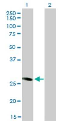 Western Blot: FHL5 Antibody (1G12-D2) [H00009457-M01]
