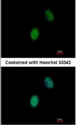 Immunocytochemistry/ Immunofluorescence: FHL5 Antibody [NBP1-32660]